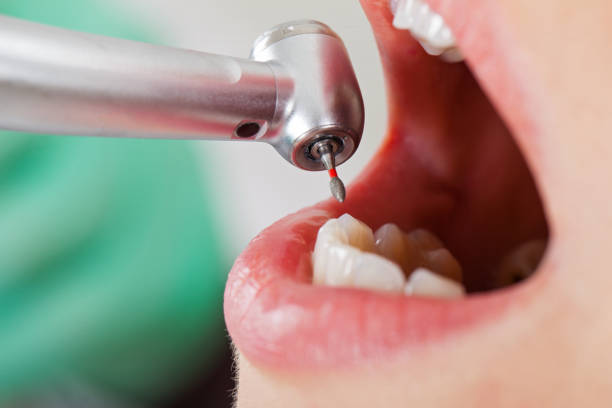 Best Emergency Root Canal Therapy in Clarksville, VA